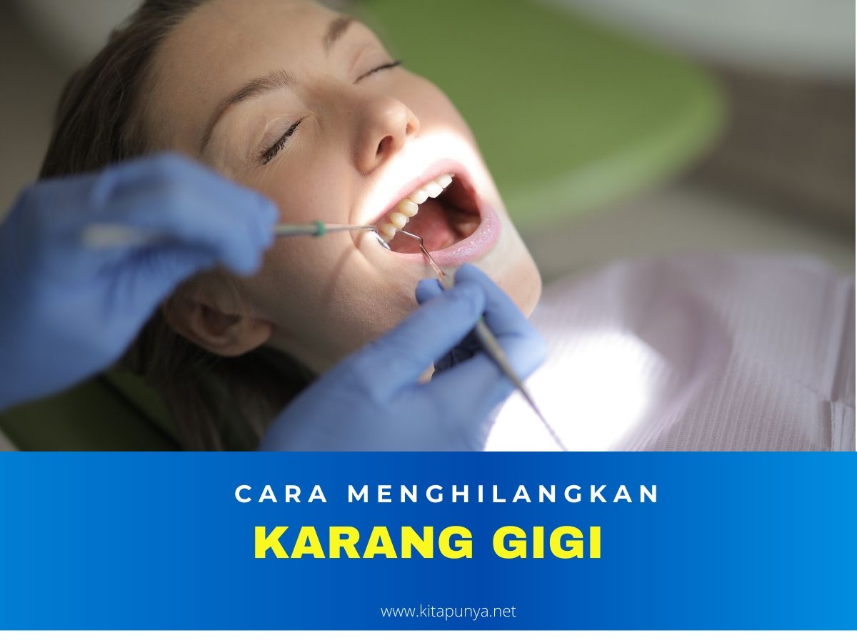 8 Cara alami menghilangkan karang gigi agar gigi putih ...